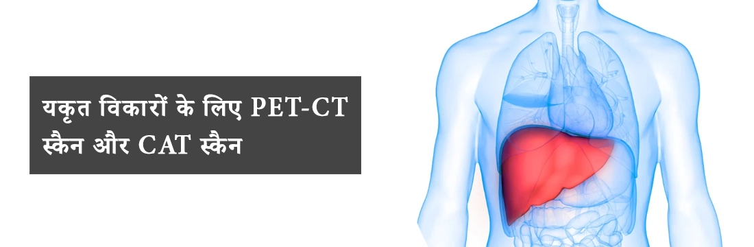 यकृत विकारों के लिए PET-CT स्कैन और CAT स्कैन